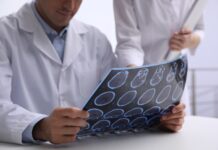 Un traitement novateur contre la maladie d’Alzheimer soumis aux autorités médicales américaines